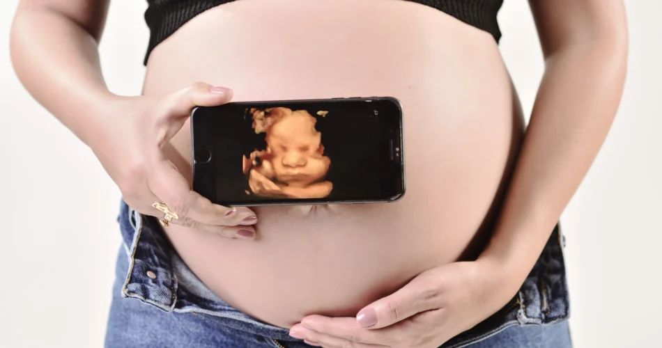 Exibindo antecipadamente seu bebê no ultrassom